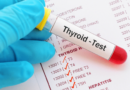 Importance of Thyroid Test - Types, Procedure and Result
