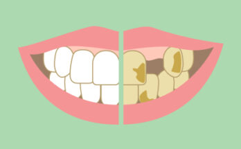 Effects Of Smoking On Teeth